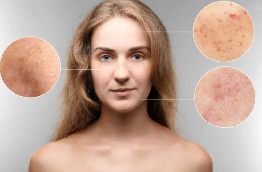 Skin Problem Ayurvedic Treatment